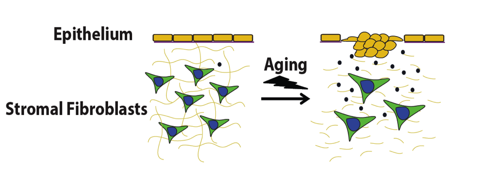 aging-cancer
